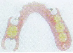 3）エステショット